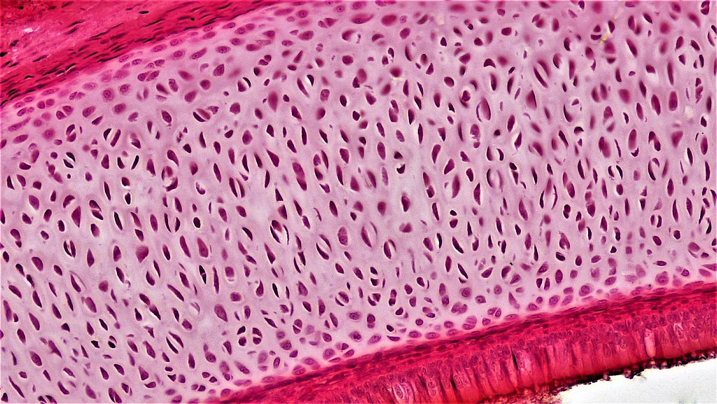 Connective Tissue Hyaline, Berkshire Bioscience Library